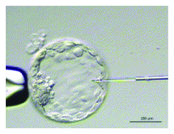  非侵襲性的胚胎著床前染色體篩檢